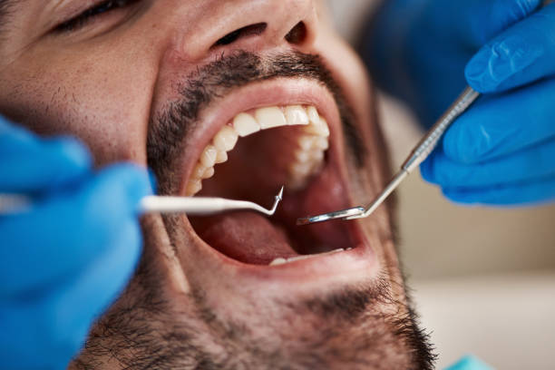 Best Holiday Emergency Dentist in New Lexington, OH