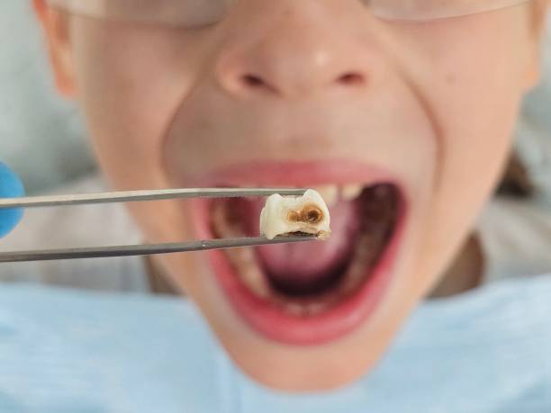 Best Emergency Cosmetic Dentistry in New Lexington, OH
